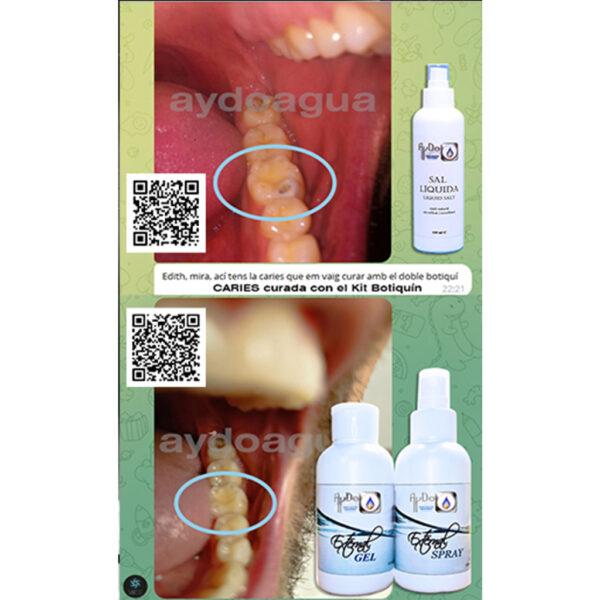 Kit Botiquin dental eco elimina Caries - Kit Dental caso caries aydoagua sal liquida