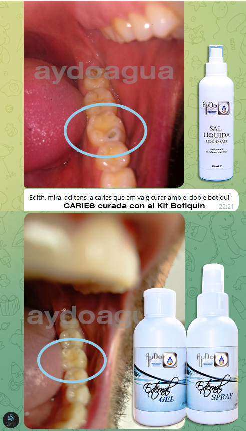 Kit Botiquin dental eco elimina Caries-Kit Dental caso caries aydoagua